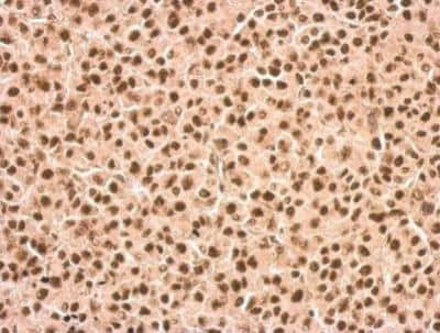 Immunohistochemistry-Paraffin: DDX23 Antibody [NBP2-16130]