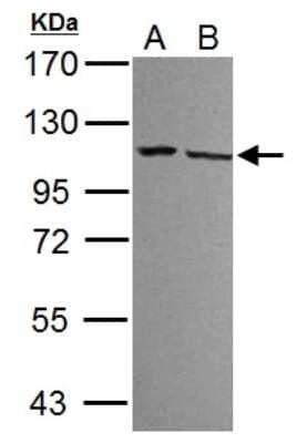 Western Blot: DDX23 Antibody [NBP2-16129]