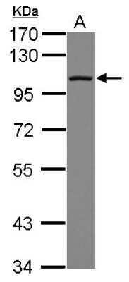 Western Blot: DDX23 Antibody [NBP2-16130]