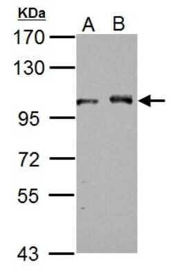 Western Blot: DDX23 Antibody [NBP2-16130]