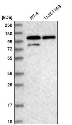 Western Blot: DDX23 Antibody [NBP2-58799]