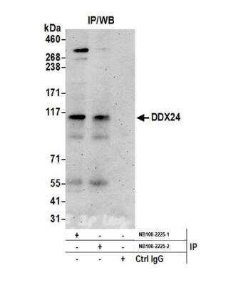 Immunoprecipitation: DDX24 Antibody [NB100-2225]