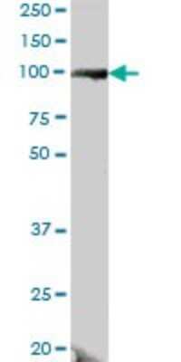 Western Blot: DDX24 Antibody [H00057062-B01P]