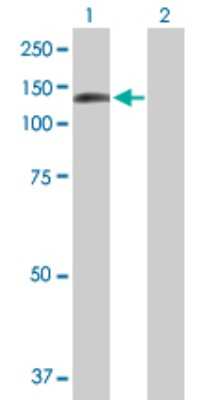 Western Blot: DDX24 Antibody [H00057062-B01P]