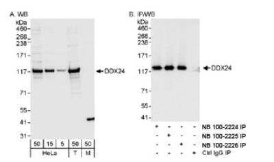 Western Blot: DDX24 Antibody [NB100-2224]