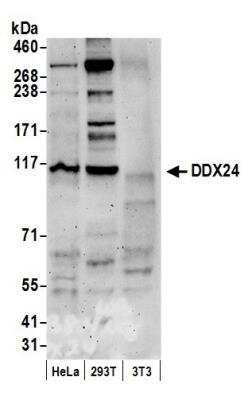 Western Blot: DDX24 Antibody [NB100-2225]