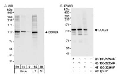 Western Blot: DDX24 Antibody [NB100-2226]