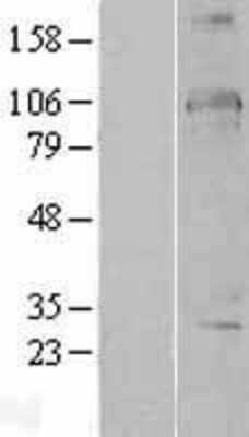 Western Blot: DDX24 Overexpression Lysate [NBL1-09789]