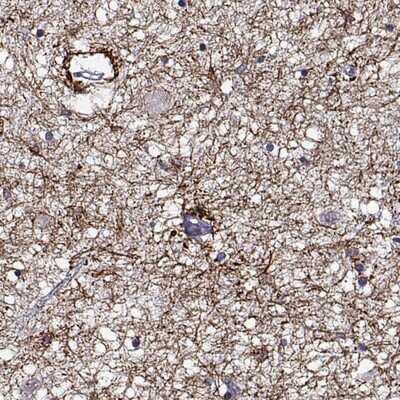 Immunohistochemistry-Paraffin: DDX25 Antibody [NBP1-83328]