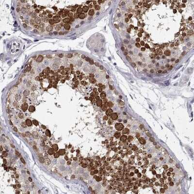 Immunohistochemistry-Paraffin: DDX25 Antibody [NBP1-83328]