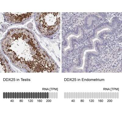 Immunohistochemistry-Paraffin: DDX25 Antibody [NBP1-83328]