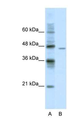 Western Blot: DDX25 Antibody [NBP1-57341]