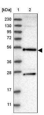 Western Blot: DDX25 Antibody [NBP1-83328]