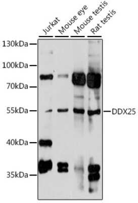 Western Blot: DDX25 AntibodyAzide and BSA Free [NBP2-92266]