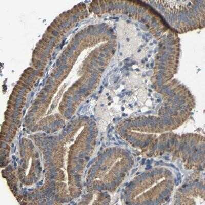 Immunohistochemistry-Paraffin: DDX26B Antibody [NBP1-81910]