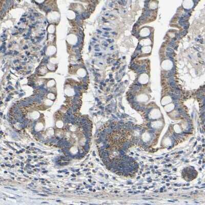 Immunohistochemistry-Paraffin: DDX26B Antibody [NBP1-81910]