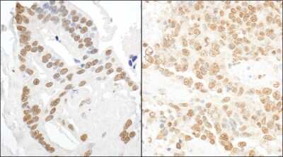 Immunohistochemistry-Paraffin: DDX27 Antibody [NBP1-26601]