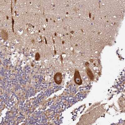 Immunohistochemistry-Paraffin: DDX27 Antibody [NBP1-91825]