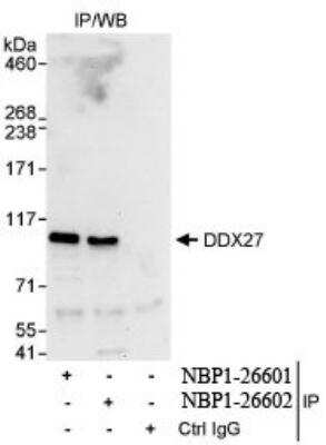 Immunoprecipitation: DDX27 Antibody [NBP1-26601]