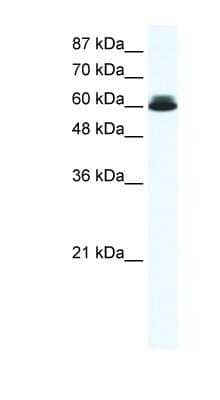 Western Blot: DDX27 Antibody [NBP1-57345]