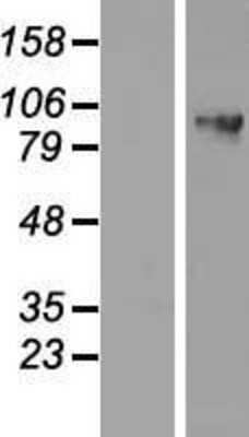 Western Blot: DDX27 Overexpression Lysate [NBP2-06905]