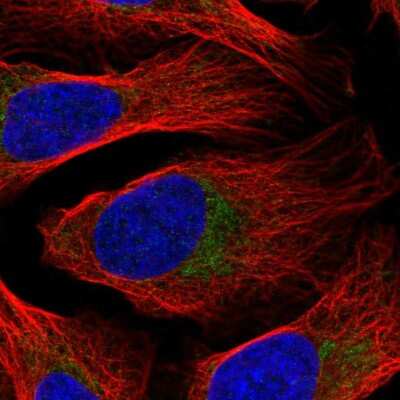 Immunocytochemistry/ Immunofluorescence: DDX28 Antibody [NBP2-58209]