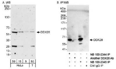 Western Blot: DDX28 Antibody [NB100-2345]