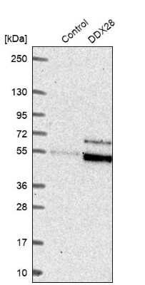 Western Blot: DDX28 Antibody [NBP1-83757]