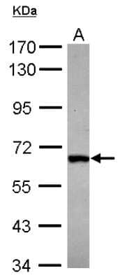 Western Blot: DDX28 Antibody [NBP2-16131]