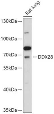 Western Blot: DDX28 AntibodyAzide and BSA Free [NBP2-92376]