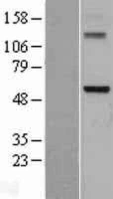 Western Blot: DDX28 Overexpression Lysate [NBL1-09791]