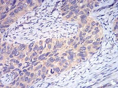 Immunohistochemistry: DDX3 Antibody (3B9E3) - BSA Free [NBP2-52457]