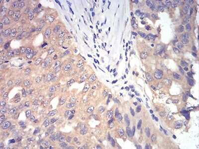 Immunohistochemistry: DDX3 Antibody (3B9E3) - BSA Free [NBP2-52457]