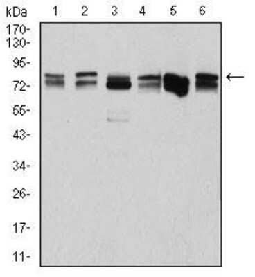 Western Blot: DDX3 Antibody (3B9E3)BSA Free [NBP2-52457]