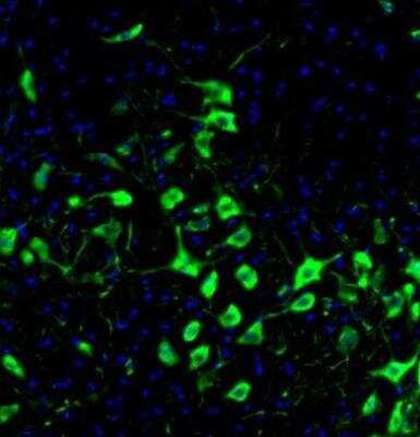 Immunohistochemistry: DDX3 Antibody [NBP1-85291]