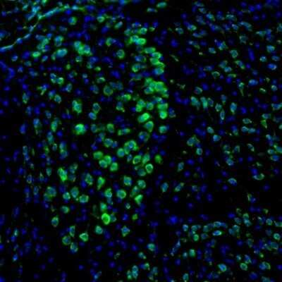 Immunohistochemistry: DDX3 Antibody [NBP1-85291]