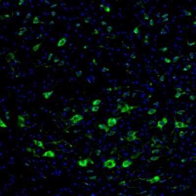 Immunohistochemistry: DDX3 Antibody [NBP1-85291]