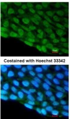 Immunocytochemistry/ Immunofluorescence: DDX3 Antibody [NBP2-16133]