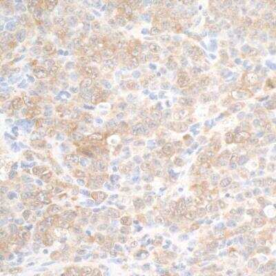 Immunohistochemistry: DDX3 Antibody [NB200-194]