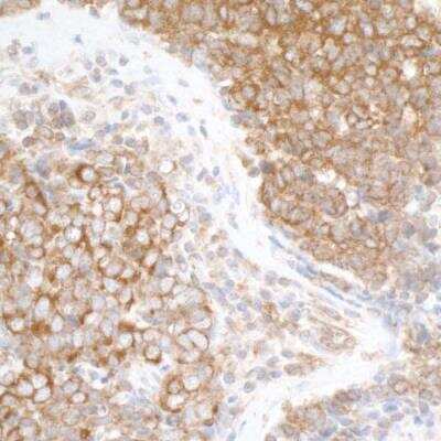 Immunohistochemistry: DDX3 Antibody [NB200-194]