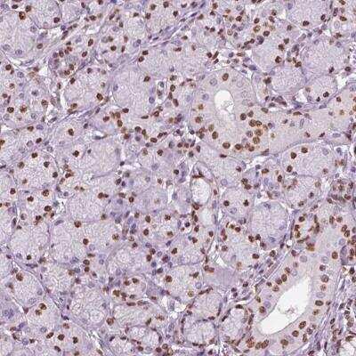 Immunohistochemistry: DDX3 Antibody [NBP2-56579]