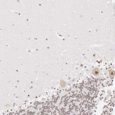Immunohistochemistry-Paraffin: DDX3 Antibody [NBP1-85291]