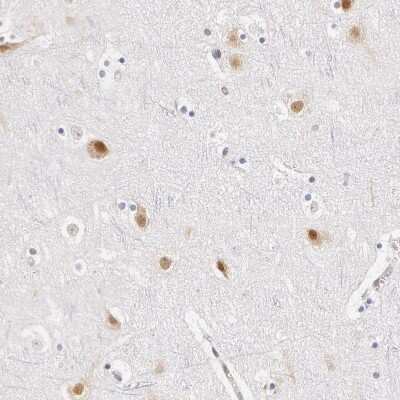Immunohistochemistry-Paraffin: DDX3 Antibody [NBP1-85291]