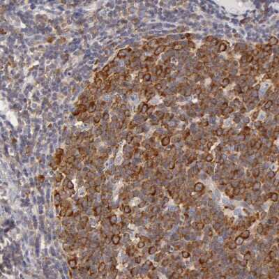Immunohistochemistry-Paraffin: DDX3 Antibody [NBP1-85291]