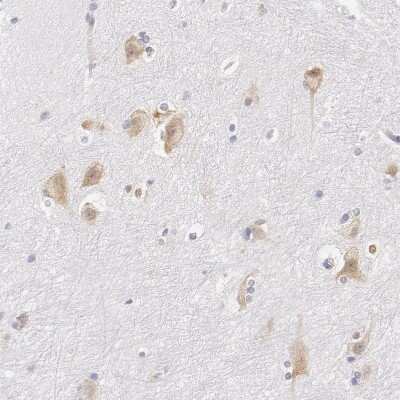 Immunohistochemistry-Paraffin: DDX3 Antibody [NBP1-85291]