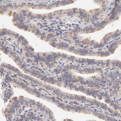 Immunohistochemistry-Paraffin: DDX3 Antibody [NBP1-85291]