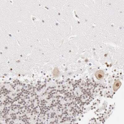 Immunohistochemistry-Paraffin: DDX3 Antibody [NBP1-85291]