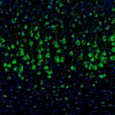 Immunohistochemistry: DDX3 Antibody [NBP1-85291]