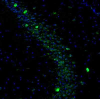 Immunohistochemistry: DDX3 Antibody [NBP1-85291]