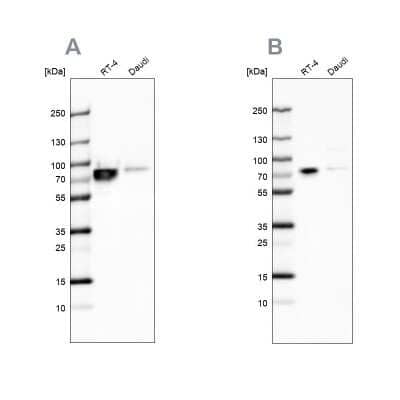 Western Blot: DDX3 Antibody [NBP1-85291]